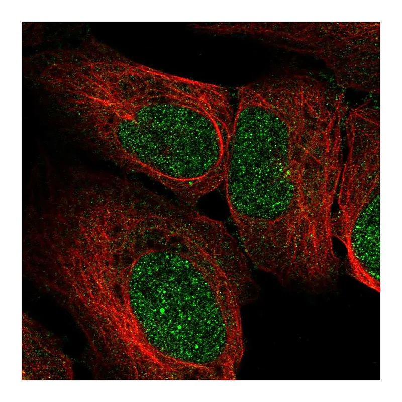 Atlas Antibodies Anti-EXOSC2 Antibody