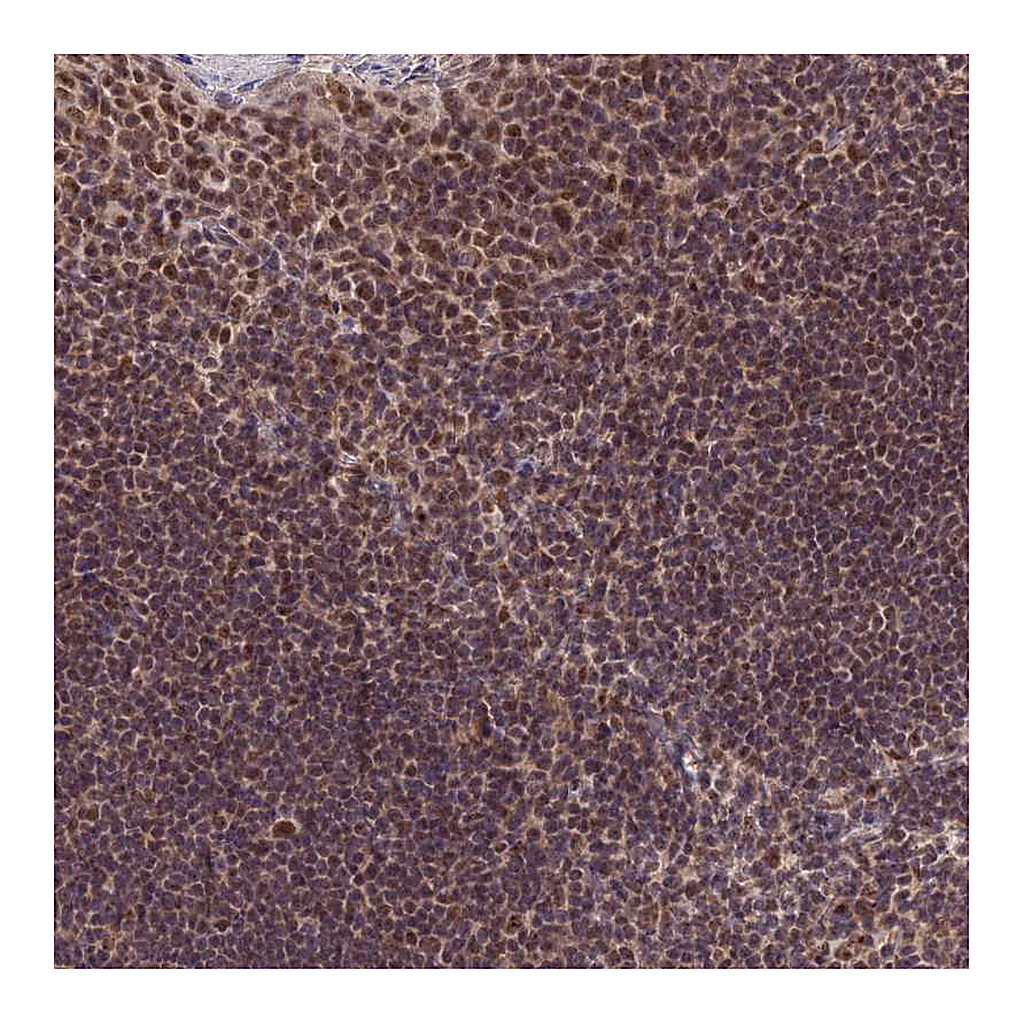 Atlas Antibodies Anti-EXOSC3 Antibody