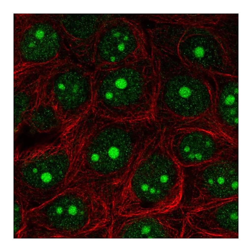 Atlas Antibodies Anti-EXOSC5 Antibody