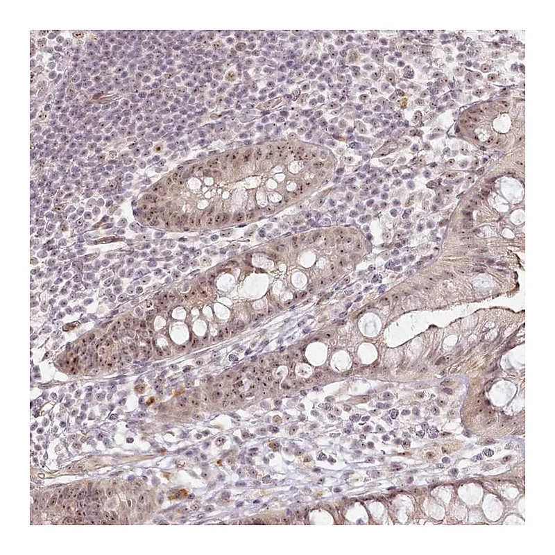 Atlas Antibodies Anti-EXOSC7 Antibody