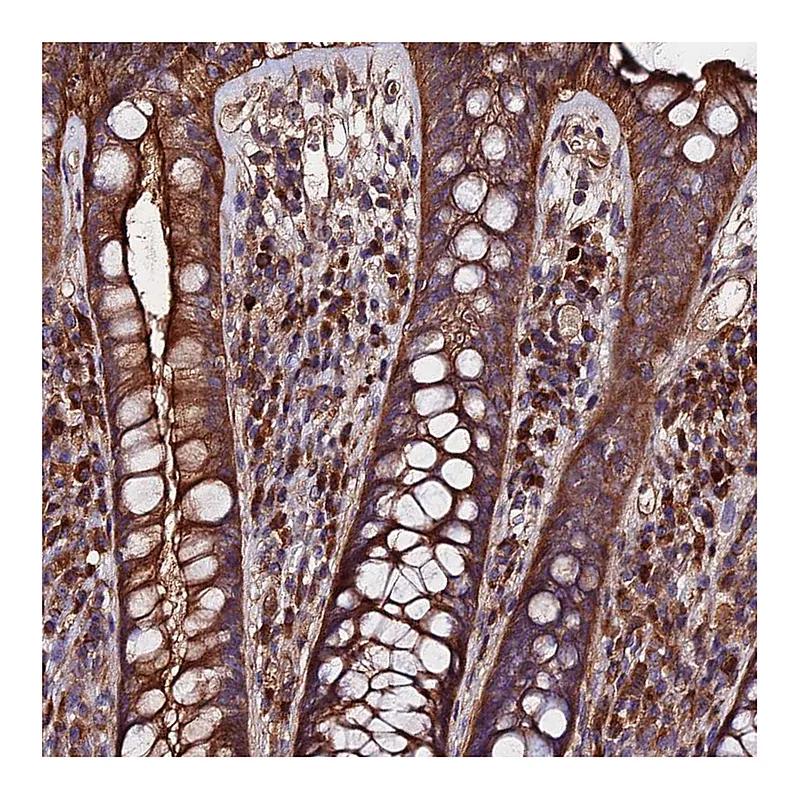 Atlas Antibodies Anti-EXT1 Antibody