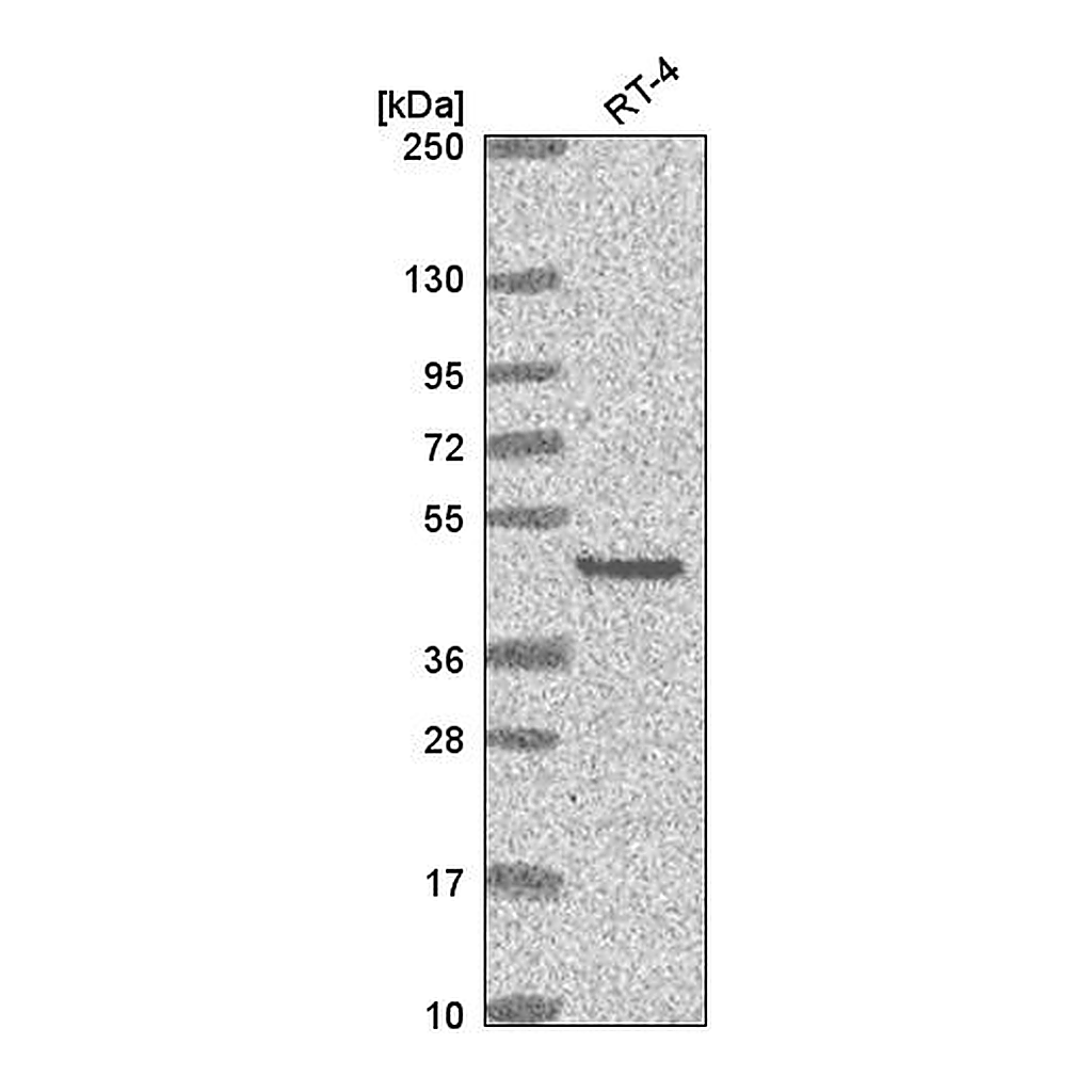 Atlas Antibodies Anti-EYA2 Antibody