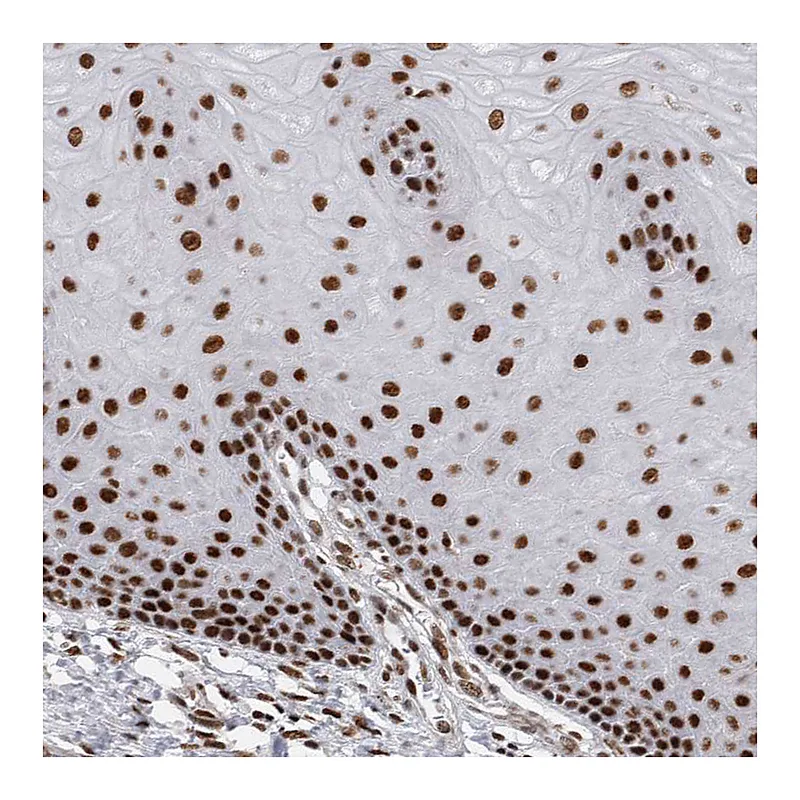 Atlas Antibodies Anti-EYA2 Antibody