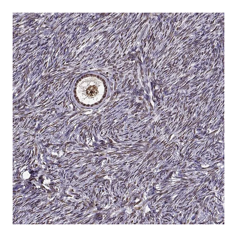 Atlas Antibodies Anti-EZH1 Antibody