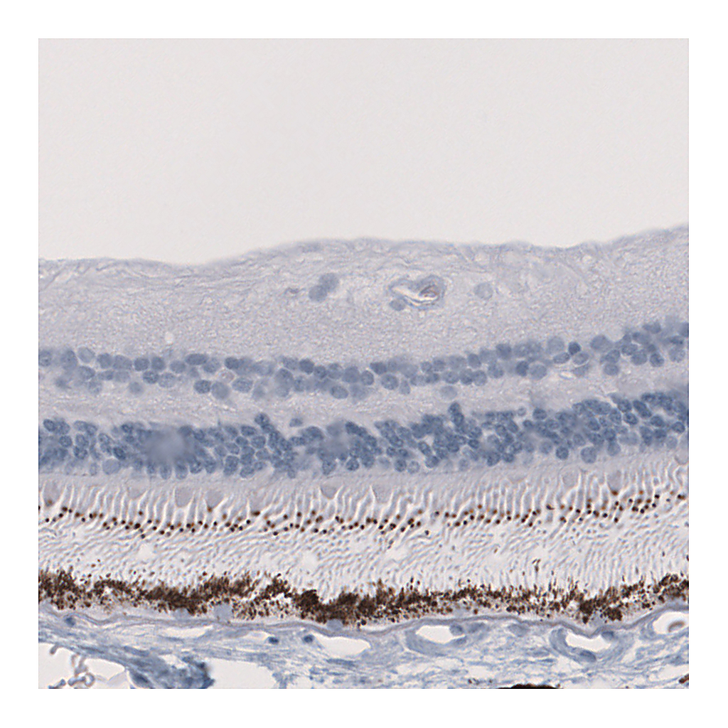 Atlas Antibodies Anti-EYS Antibody