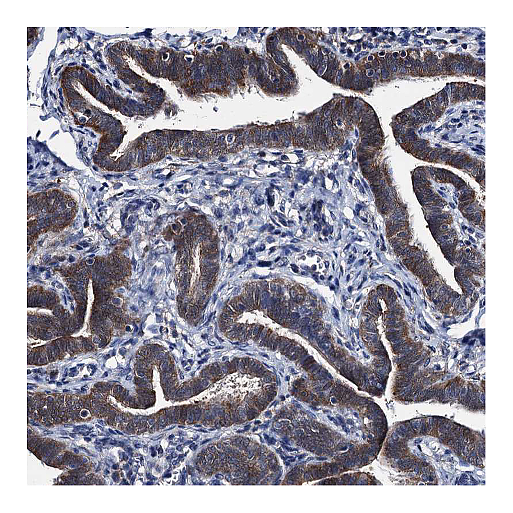 Atlas Antibodies Anti-EYA4 Antibody