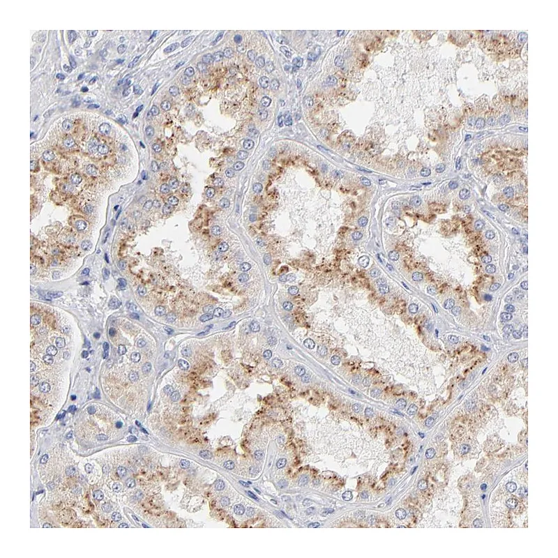 Atlas Antibodies Anti-F12 Antibody