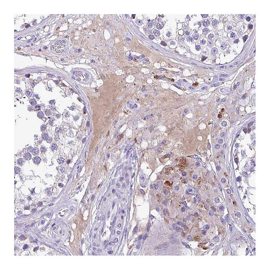 Atlas Antibodies Anti-F13B Antibody