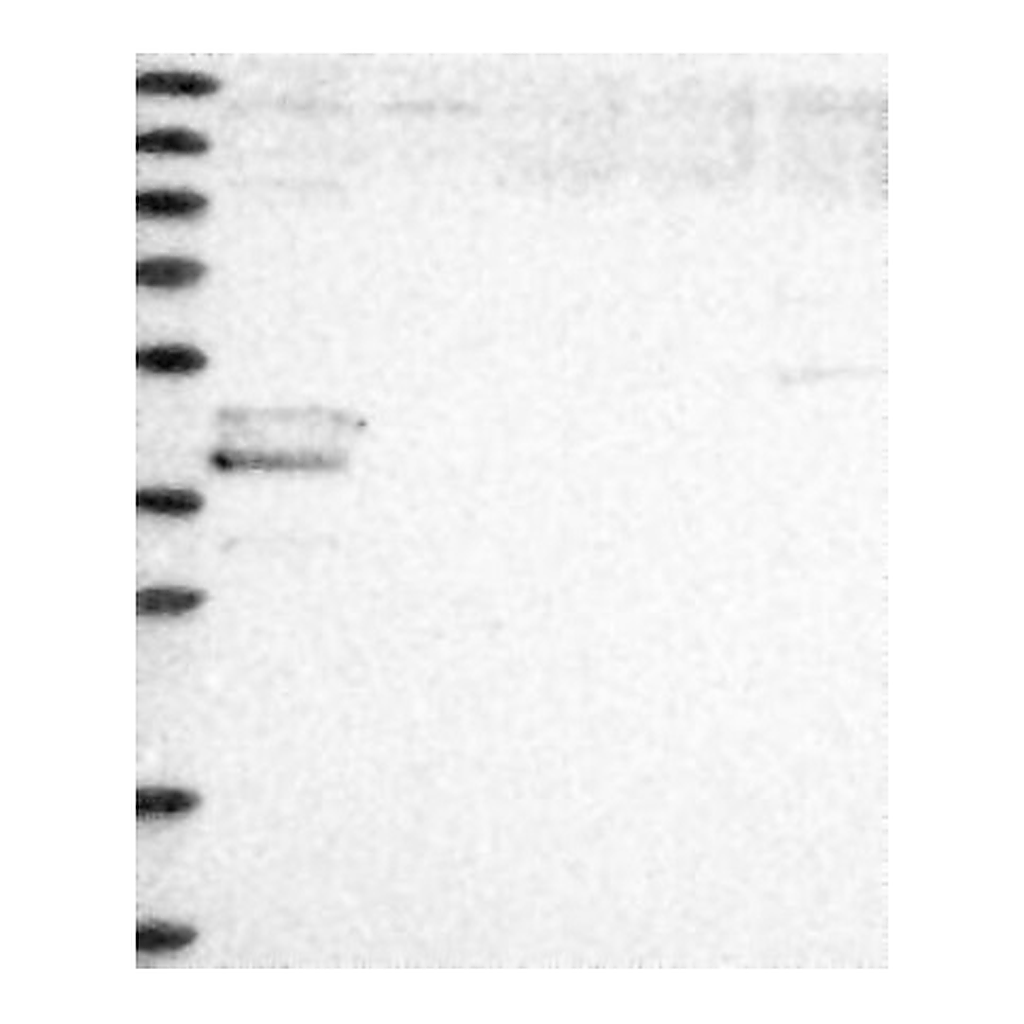Atlas Antibodies Anti-F2RL3 Antibody