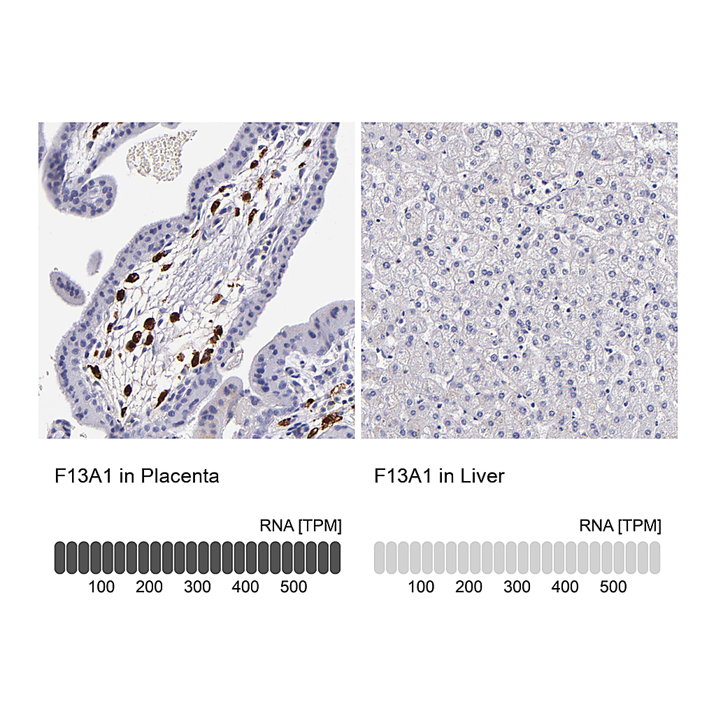 Atlas Antibodies Anti-F13A1 Antibody