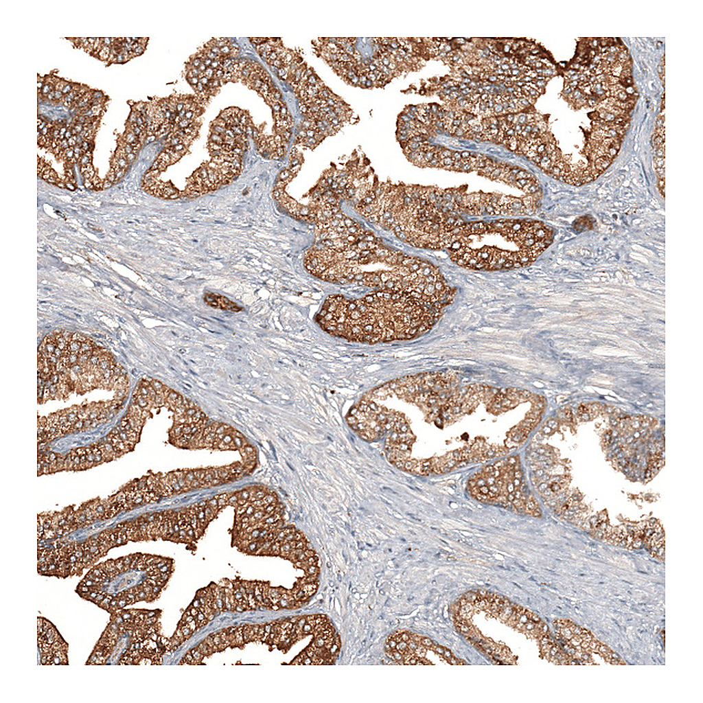 Atlas Antibodies Anti-F8A1 Antibody