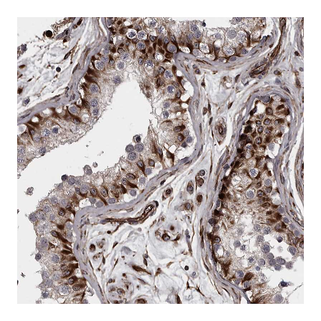 Atlas Antibodies Anti-FAAP100 Antibody
