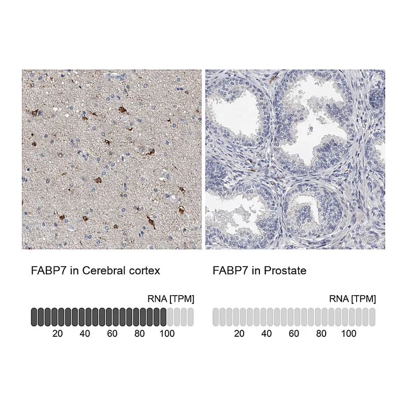 Atlas Antibodies Anti-FABP7 Antibody