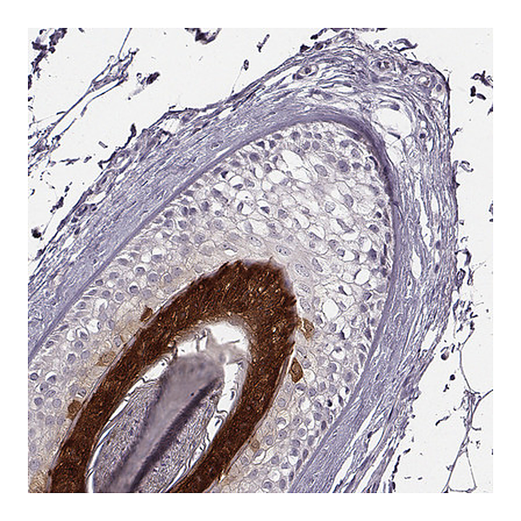 Atlas Antibodies Anti-FABP9 Antibody