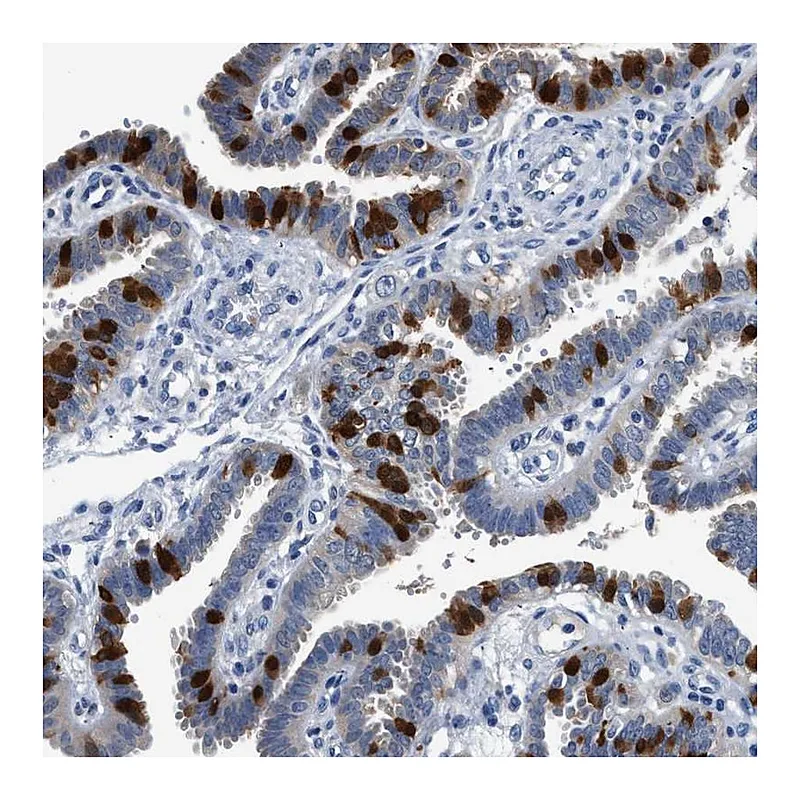 Atlas Antibodies Anti-FADS6 Antibody