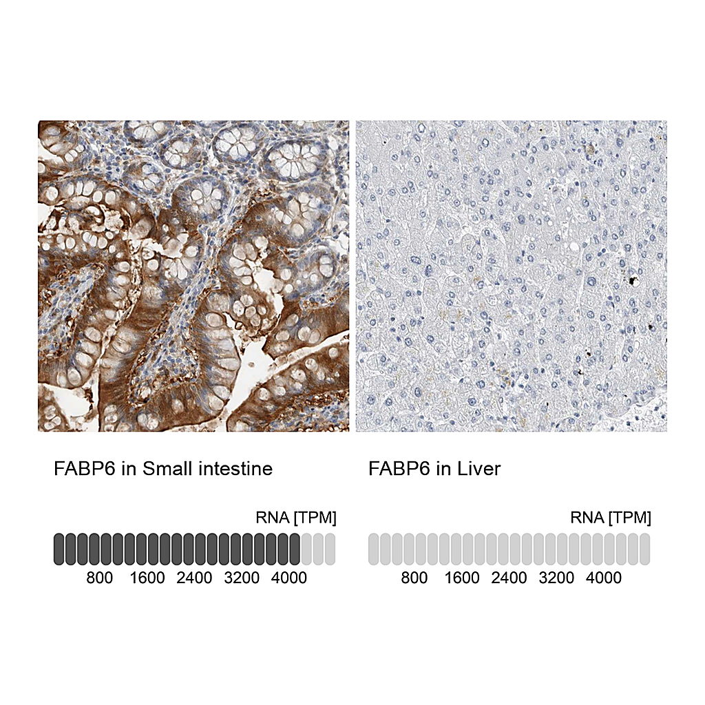 Atlas Antibodies Anti-FABP6 Antibody