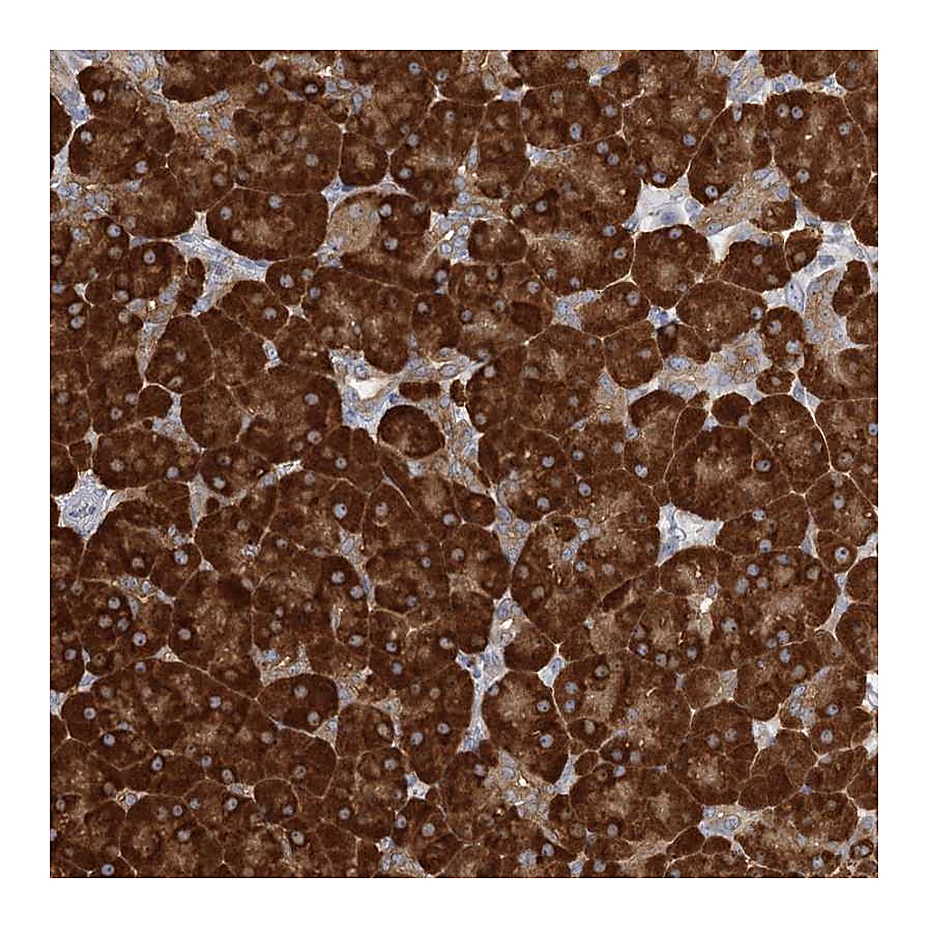 Atlas Antibodies Anti-FAM110C Antibody