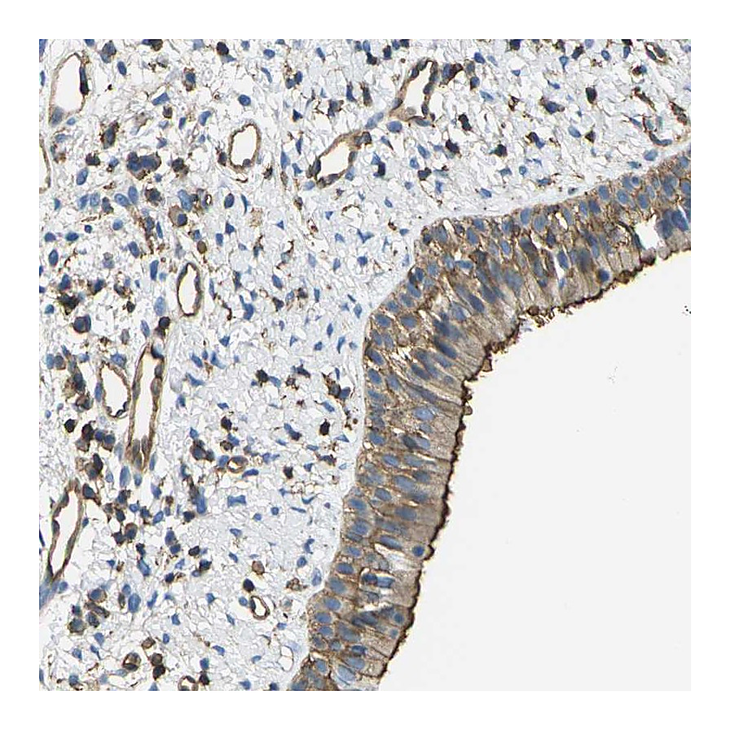 Atlas Antibodies Anti-FAM110D Antibody