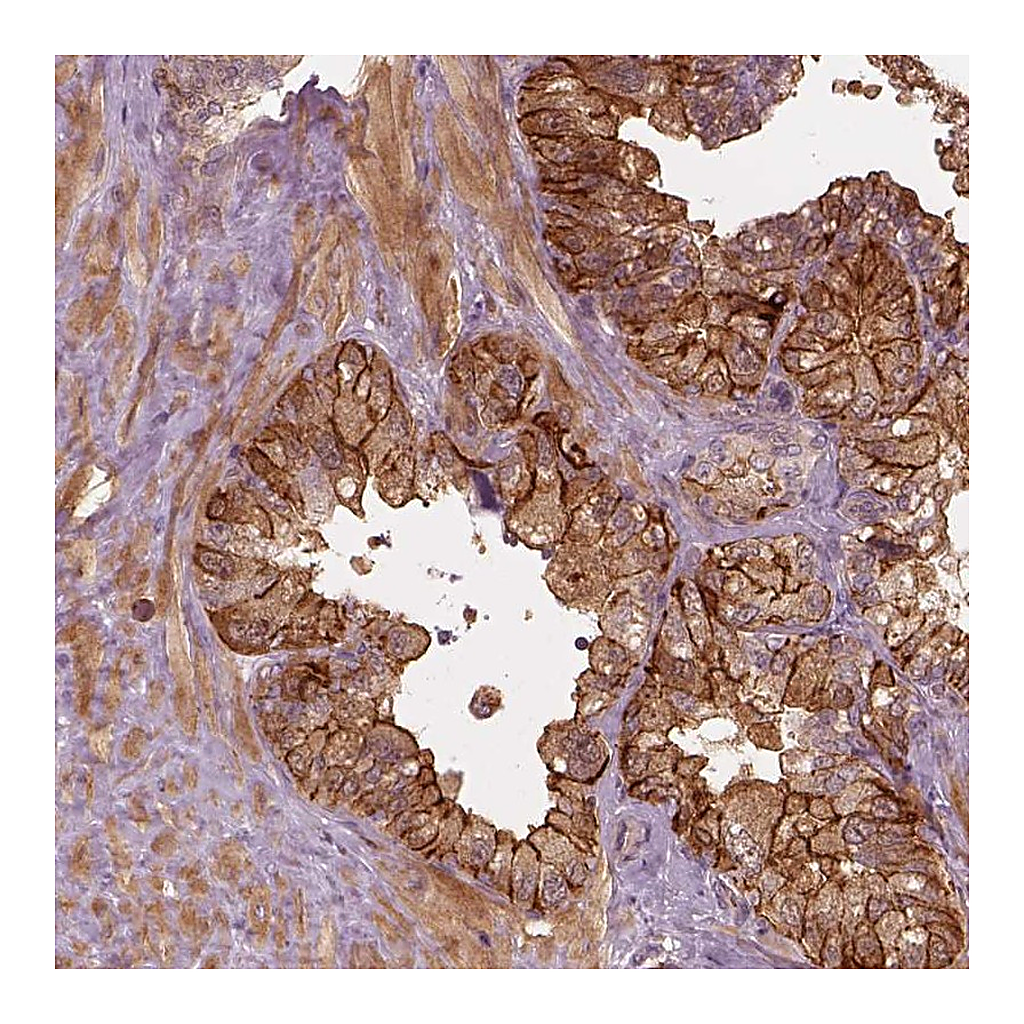 Atlas Antibodies Anti-FAM107B Antibody