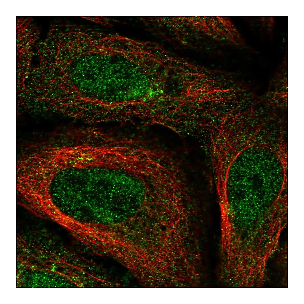 Atlas Antibodies Anti-FAM114A1 Antibody