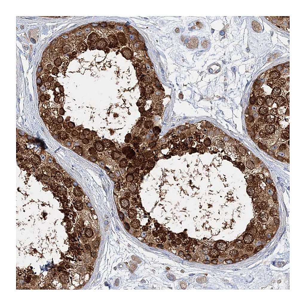 Atlas Antibodies Anti-FAM114A2 Antibody