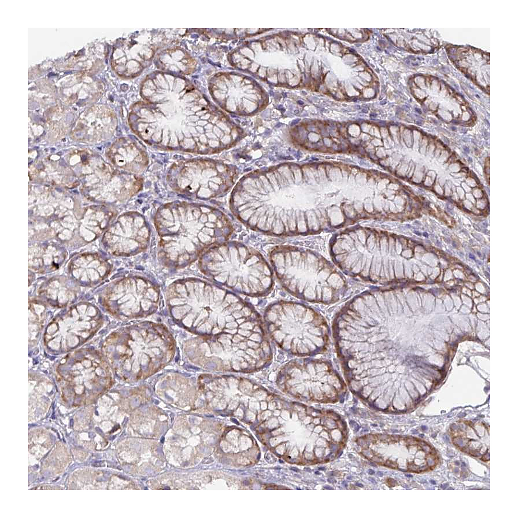 Atlas Antibodies Anti-FAM120A Antibody