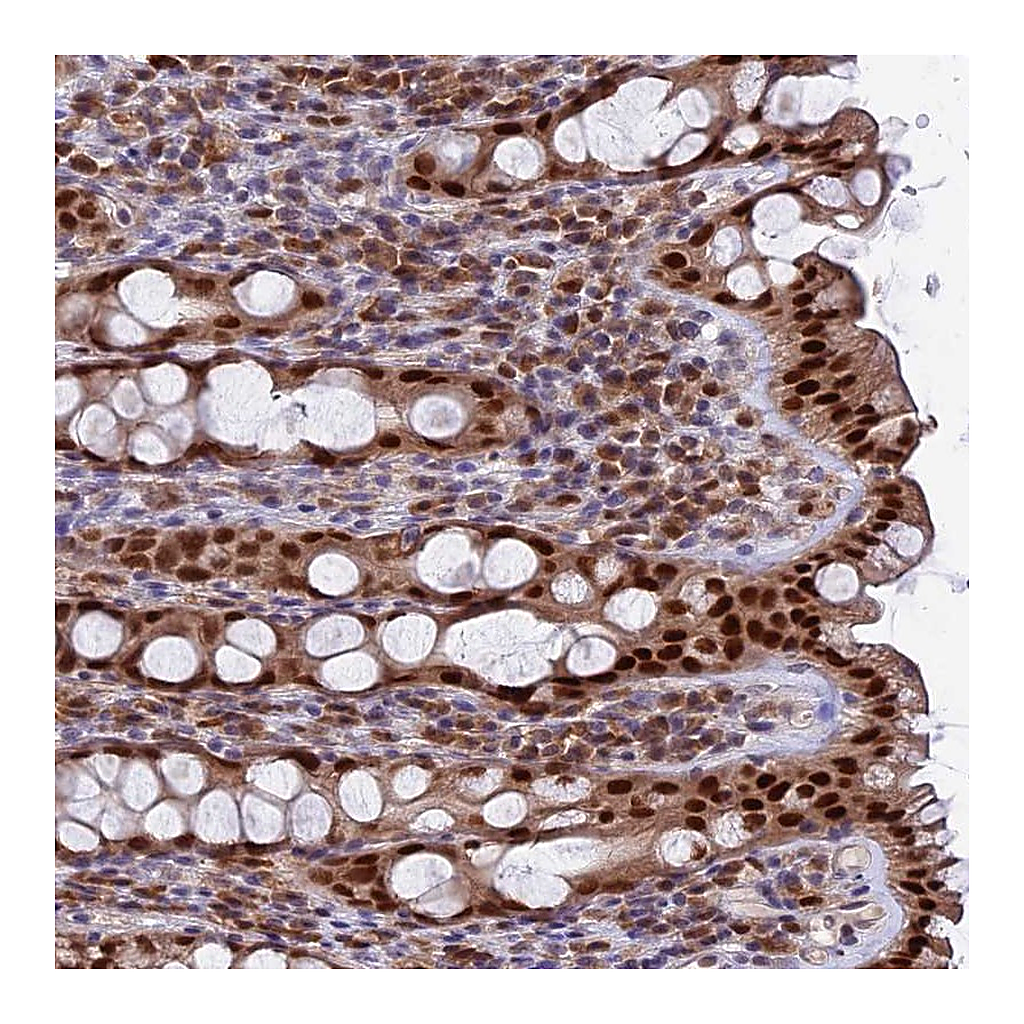 Atlas Antibodies Anti-FAM118B Antibody