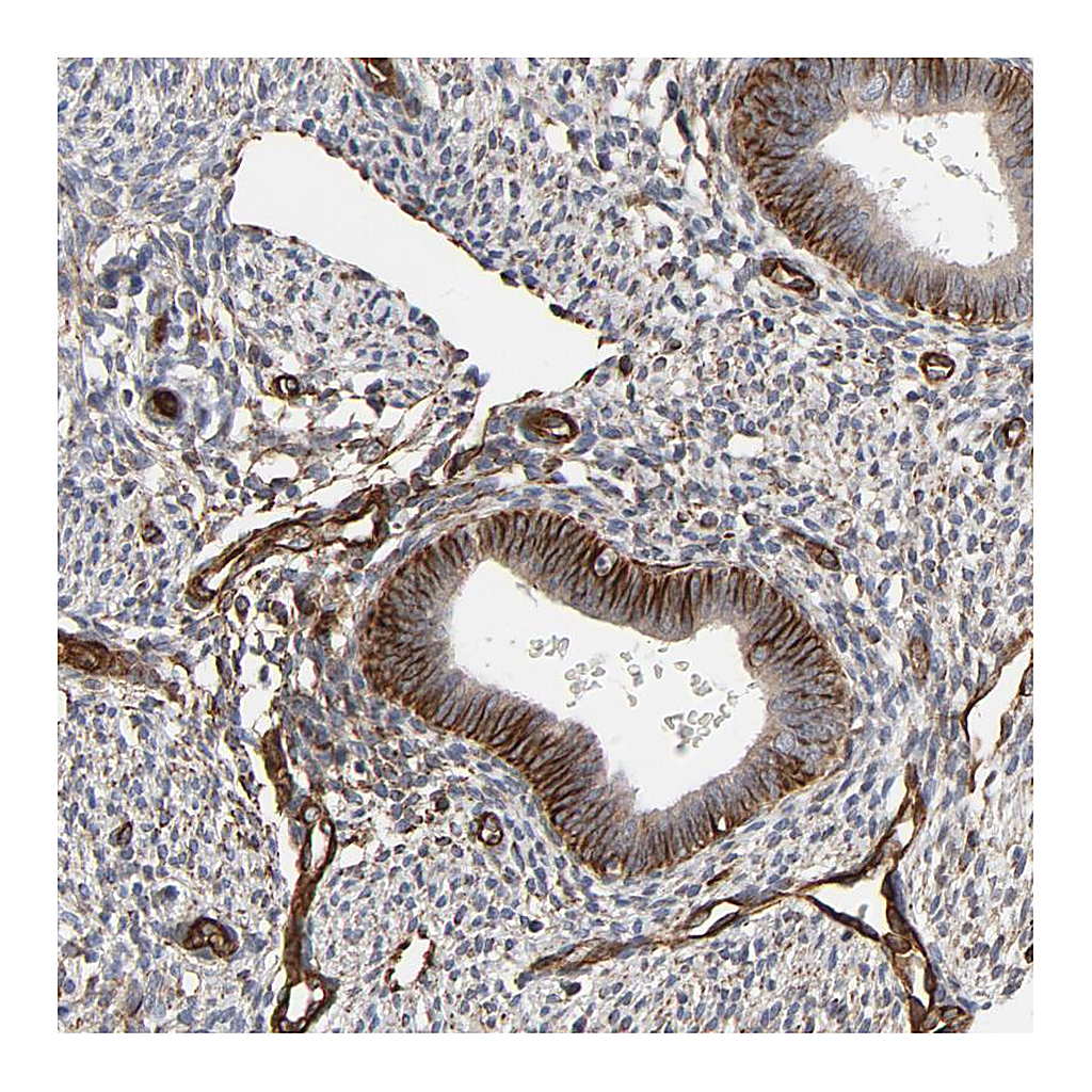 Atlas Antibodies Anti-FAM118A Antibody