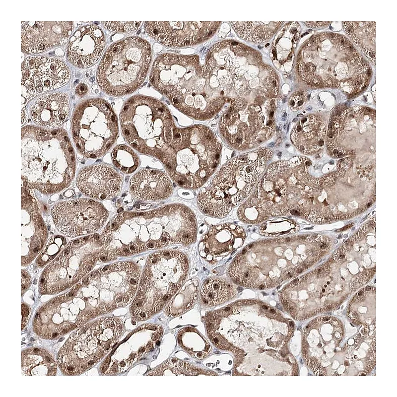 Atlas Antibodies Anti-FAM120B Antibody