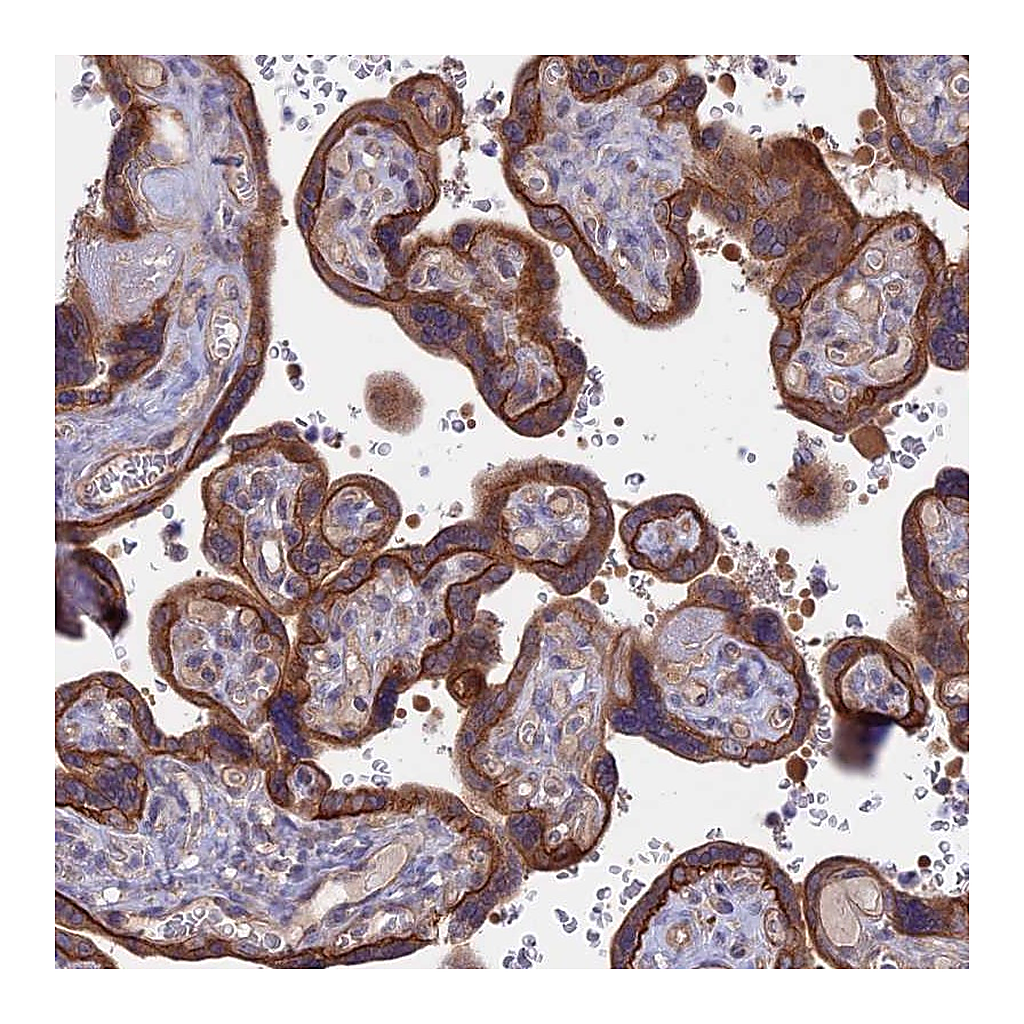 Atlas Antibodies Anti-FAM126A Antibody