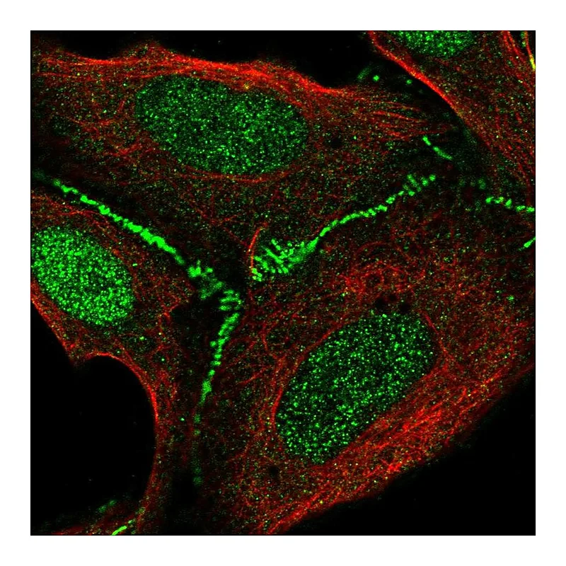 Atlas Antibodies Anti-FAM126B Antibody