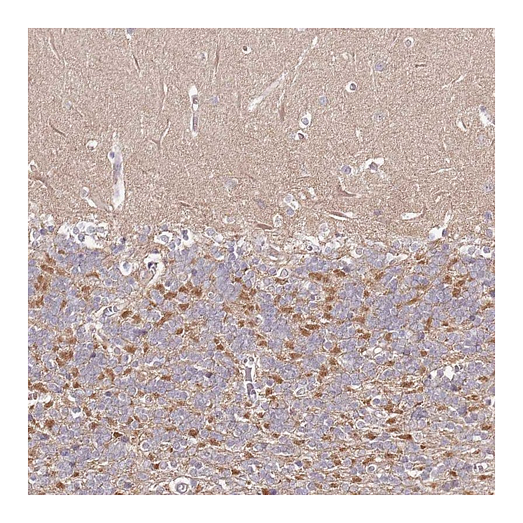 Atlas Antibodies Anti-FAM126B Antibody