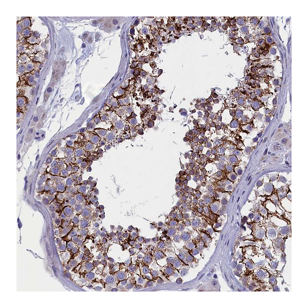 Atlas Antibodies Anti-FAM129C Antibody