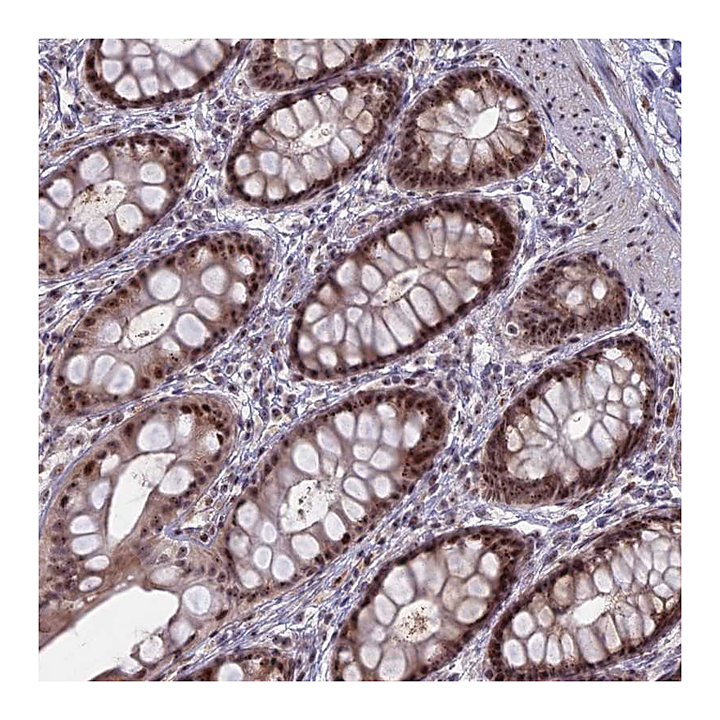 Atlas Antibodies Anti-FAM131A Antibody