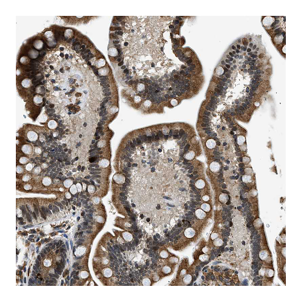 Atlas Antibodies Anti-FAM134C Antibody