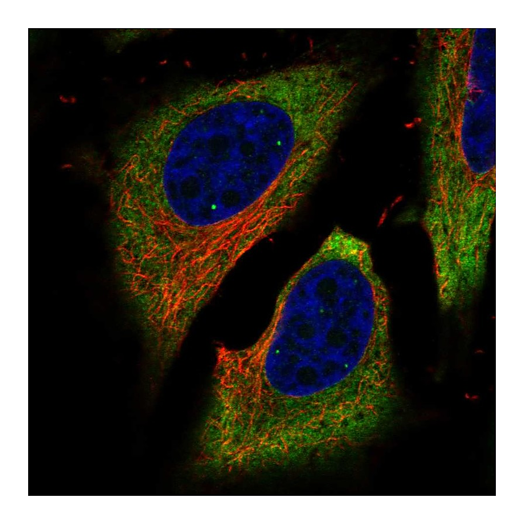 Atlas Antibodies Anti-FAM134B Antibody