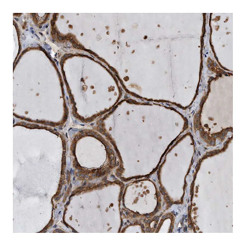 Atlas Antibodies Anti-FAM136A Antibody