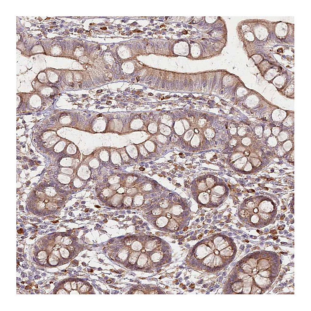 Atlas Antibodies Anti-FAM13A Antibody