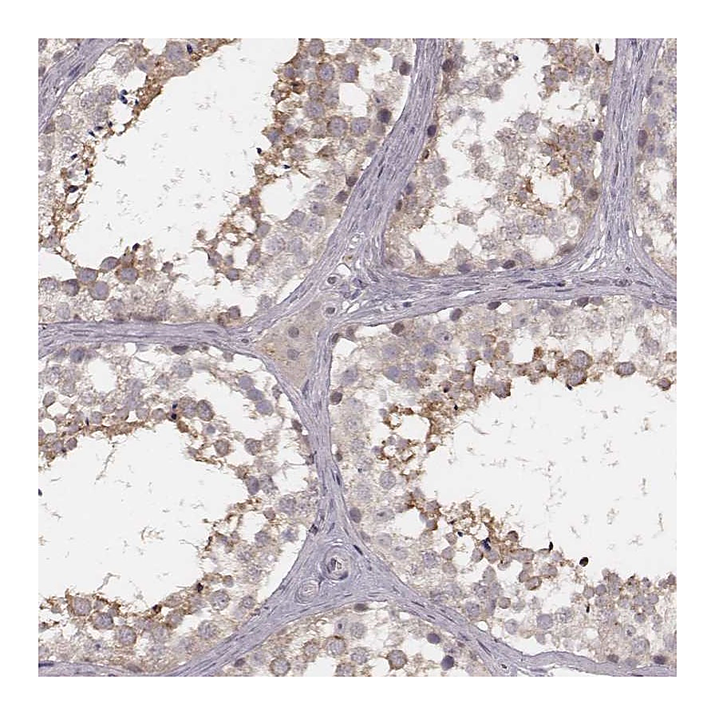 Atlas Antibodies Anti-FAM13B Antibody