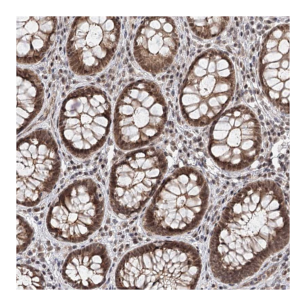 Atlas Antibodies Anti-FAM13C Antibody