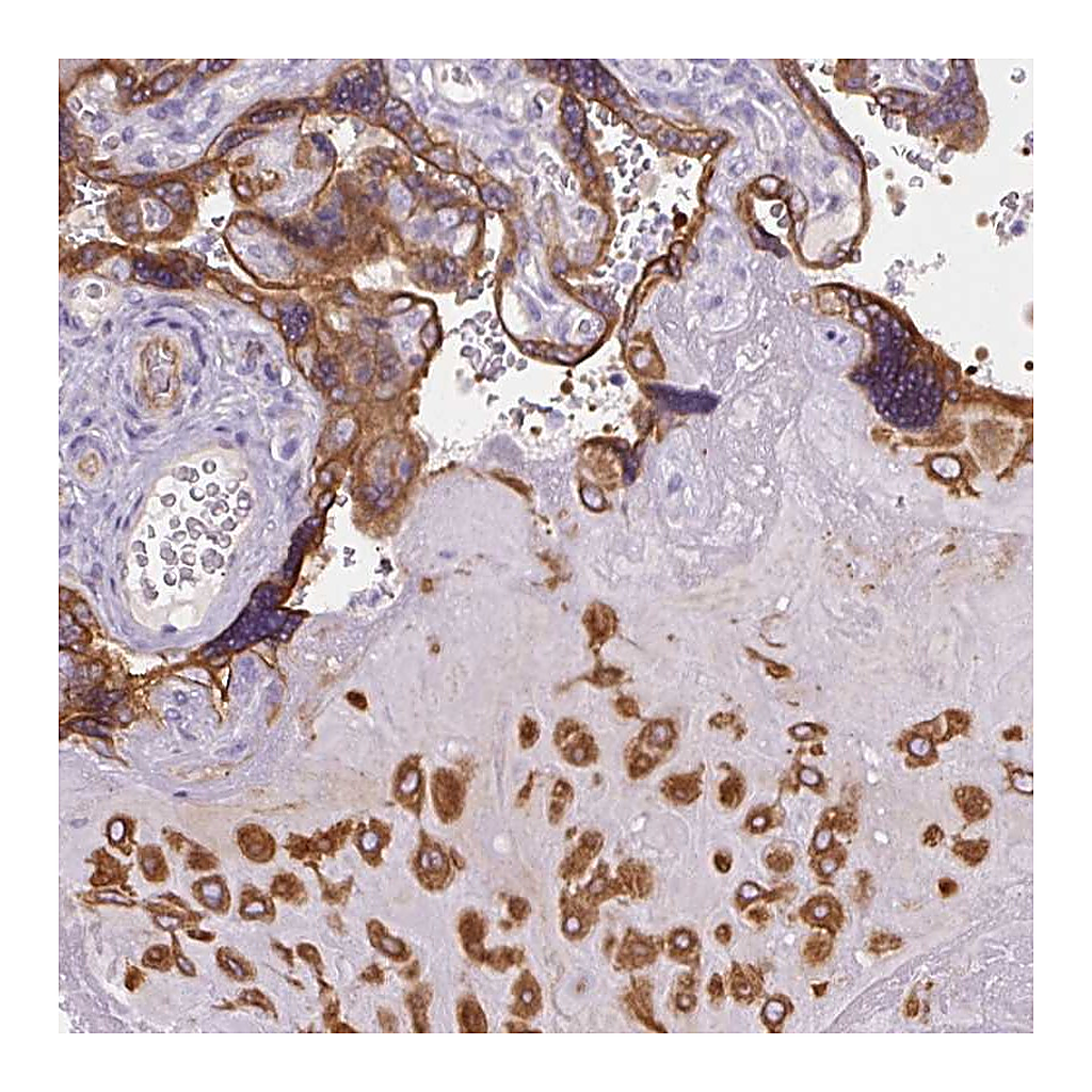 Atlas Antibodies Anti-FAM149A Antibody