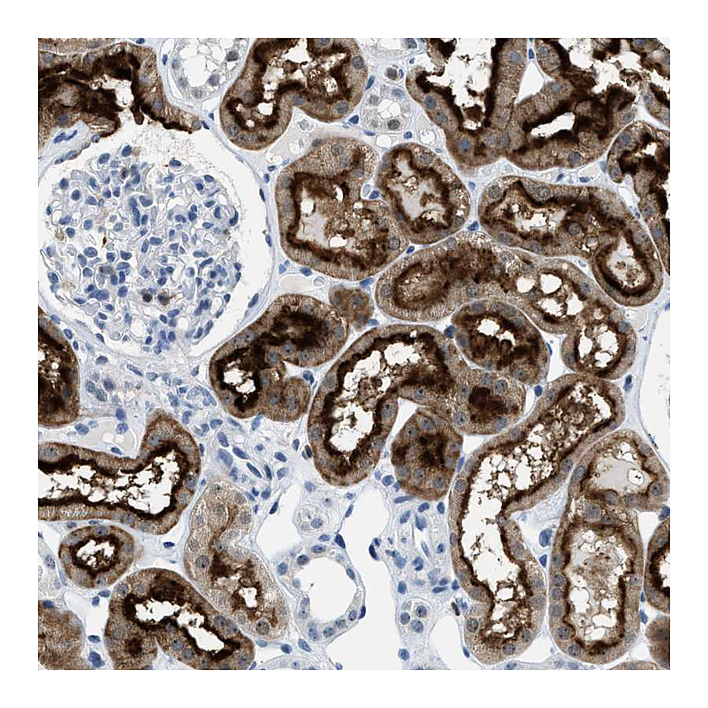 Atlas Antibodies Anti-FAM151A Antibody