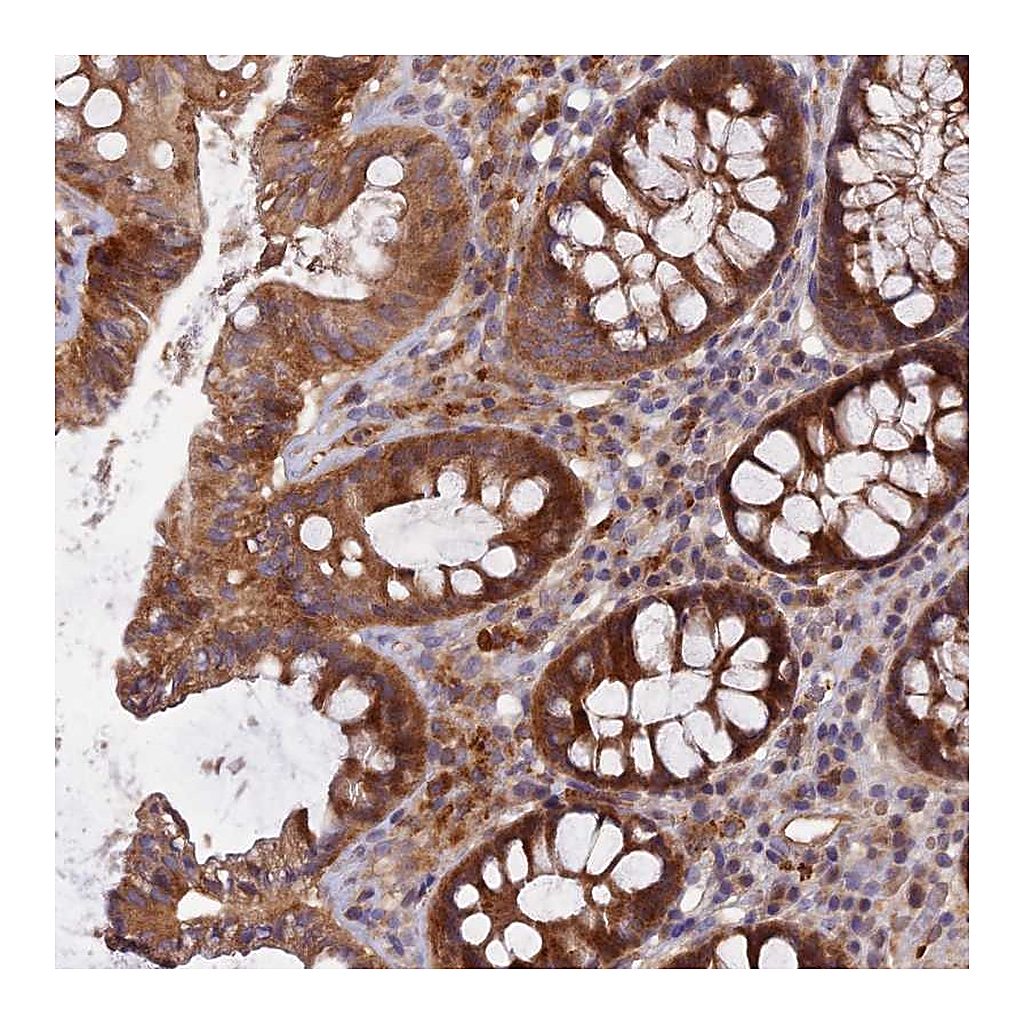 Atlas Antibodies Anti-FAM151B Antibody