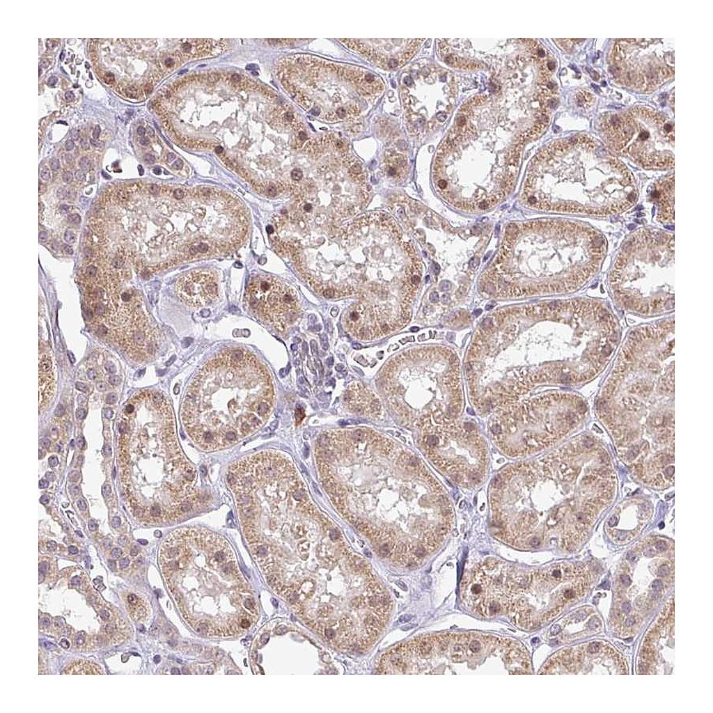 Atlas Antibodies Anti-FAM153A Antibody