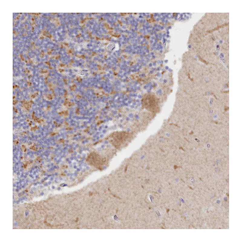 Atlas Antibodies Anti-FAM149B1 Antibody