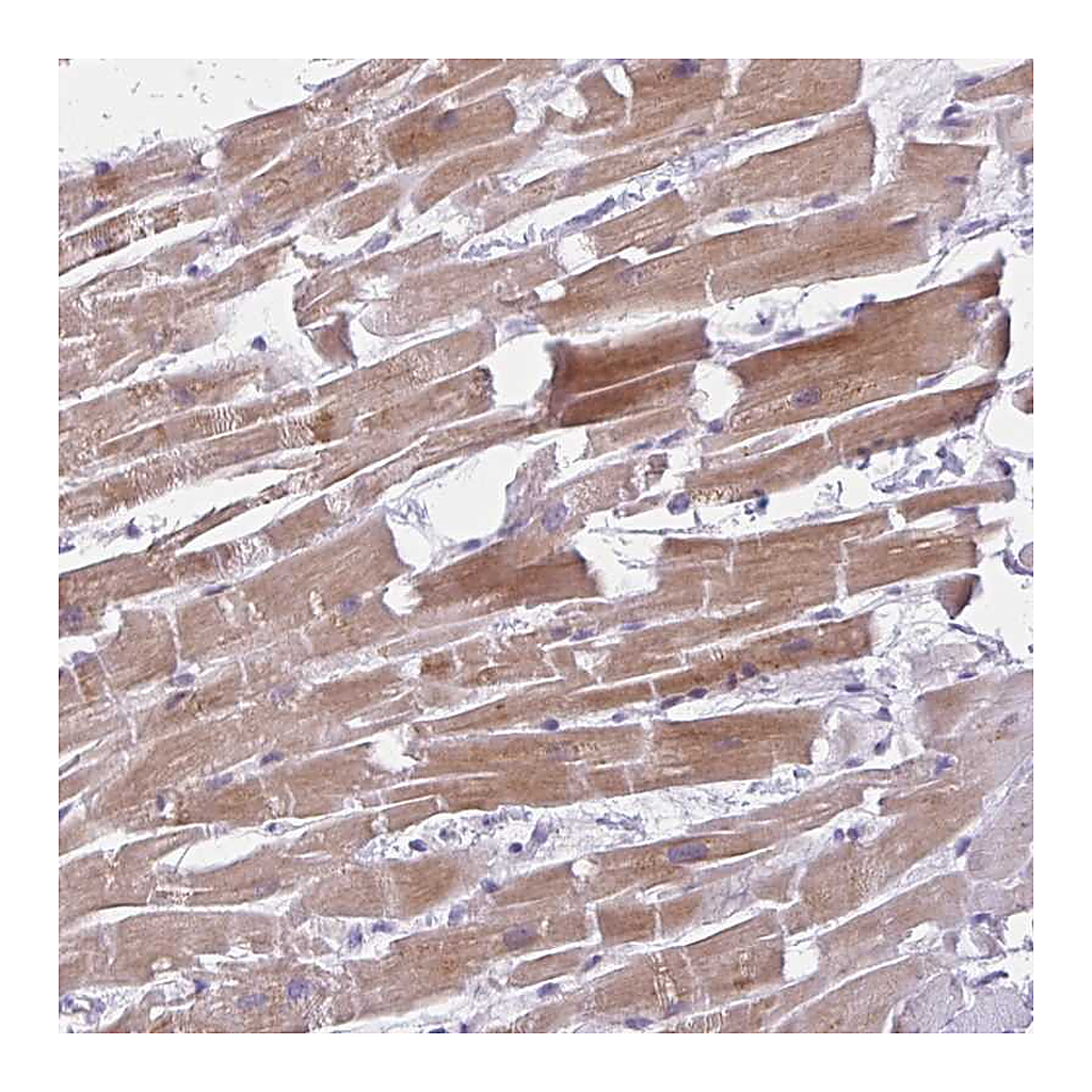 Atlas Antibodies Anti-FAM153B Antibody