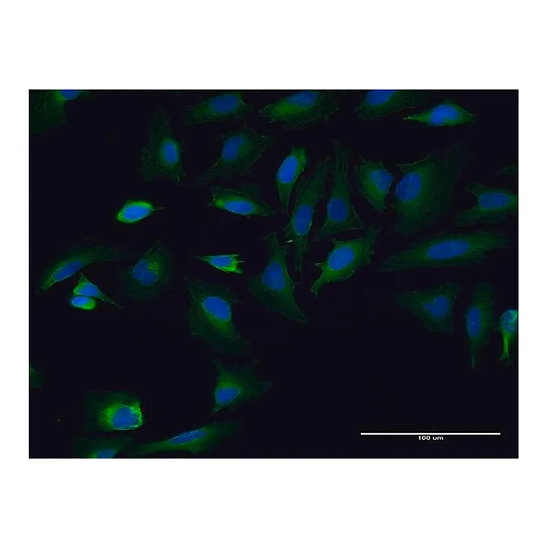 Merck Monoclonal Anti-TPR, (N-terminal) antibody produced in mouse