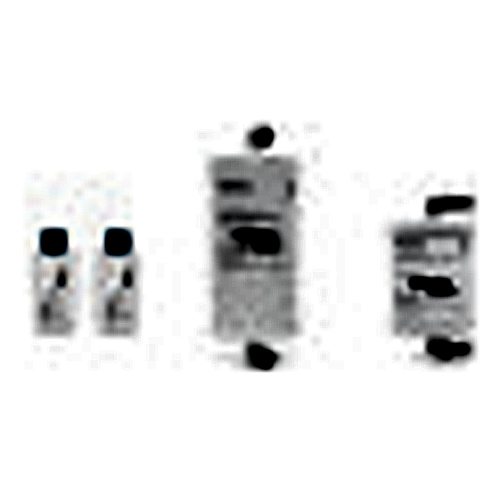[정수기 부품] Consumables package for Arium® Comfort II (SB-12-03-0601)