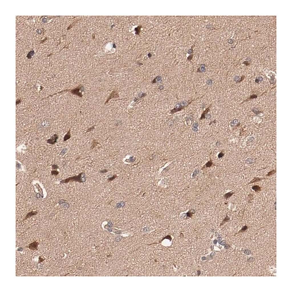 Merck Anti-PITPNM2 antibody produced in rabbit