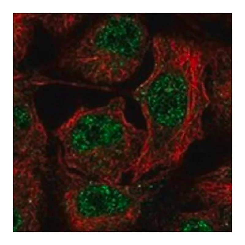 Merck Anti-STARD3 antibody produced in rabbit
